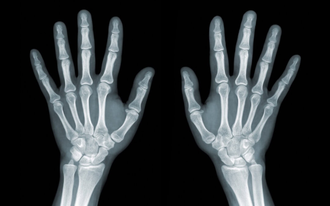 Rheumatology