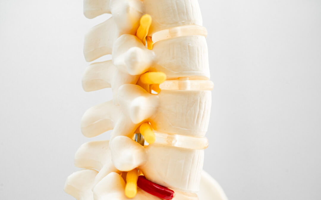 Sciatica and Herniated discs